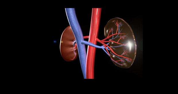 Kidney disease can be a silent killer!