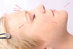 Acupuncture may benefit patients with chronic obstructive pulmonary disease