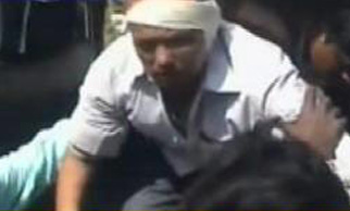 TMC workers chop off panchayat employee’s ear