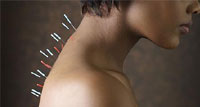 Acupuncture may ease severe nerve pain